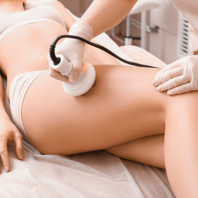 CELLULITE REDUCTION